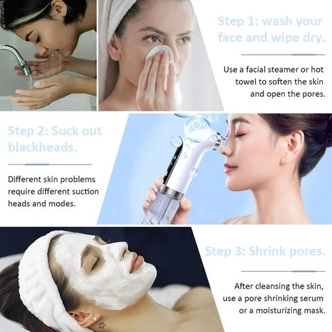 Hrdradermabrasion with Water Circulation Facial Blackhead Pore Peel Cleanse