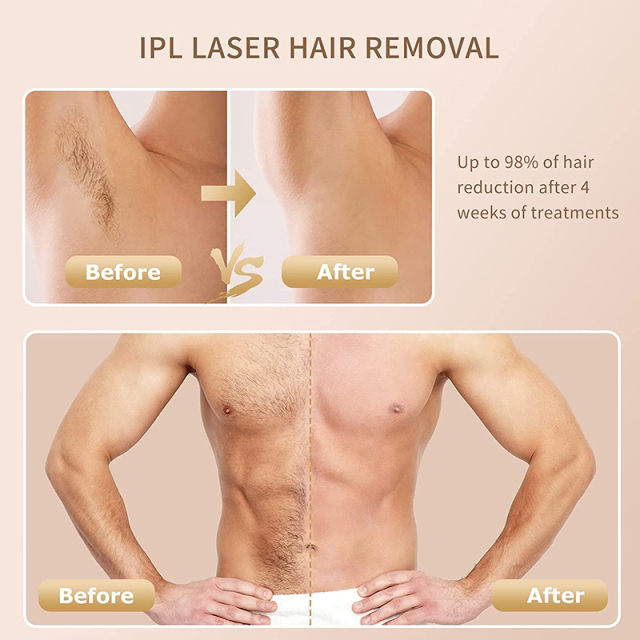 Permanent Painless IPL Hair Remove Laser Device Appliance Sapphire Cooling at Home Ice Laser Hair Removal Machine