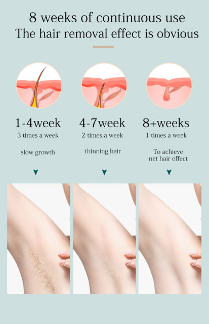 Home Use Permanent 60W Flash Freezing Point Painless Epilator IPL Ice Cooling Laser Hair Removal Device