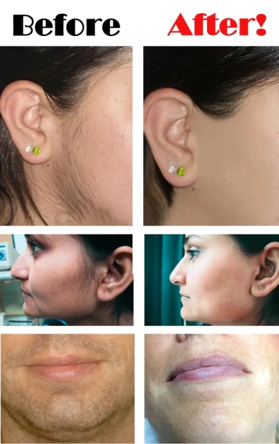 Home Use Beauty Hair Remove Appliance Facial Body Laser IPL Hair Removal Device for Women