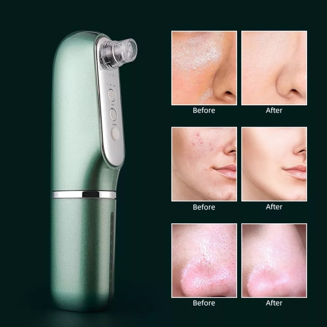 Blackhead Remover Hydra Peeling Reduce Grease Dermabrasion