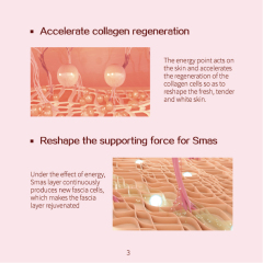 Lift Wrinkle Treatment Skin Tighten Salon SPA Hello Skin Beauty Equipment Mini Hifu Machine