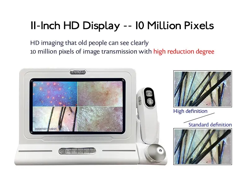 3D 11 Inch Screen Hair Diagnosis Analyzer Skin All in 1 Machine Four-Spectral UV Light Facial Skin Analyzer