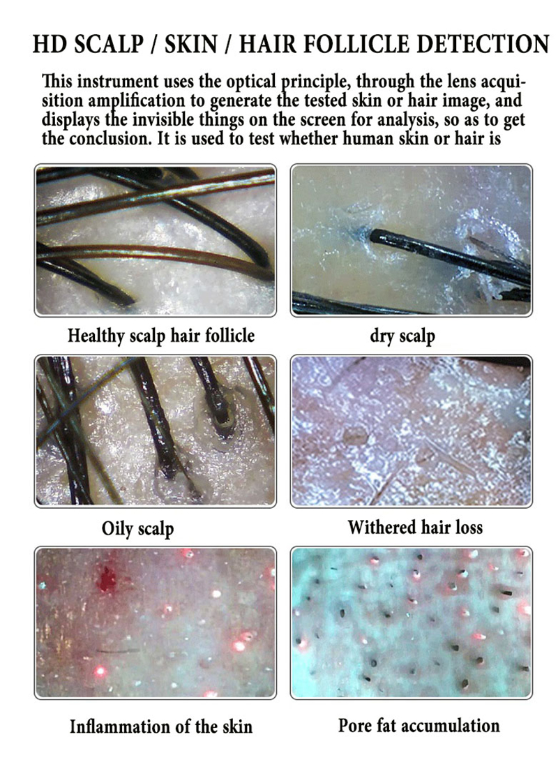 3D 11 Inch Screen Hair Diagnosis Analyzer Skin All in 1 Machine Four-Spectral UV Light Facial Skin Analyzer