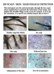 3D 11 Inch Screen Hair Diagnosis Analyzer Skin All in 1 Machine Four-Spectral UV Light Facial Skin Analyzer