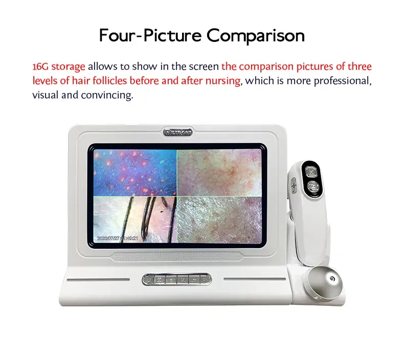 3D 11 Inch Screen Hair Diagnosis Analyzer Skin All in 1 Machine Four-Spectral UV Light Facial Skin Analyzer