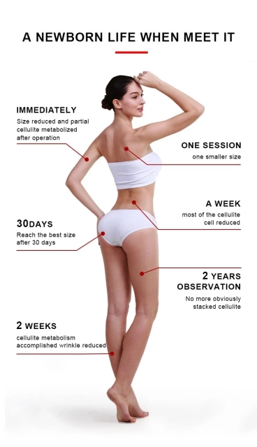 Hello Body Hand Held Mini Hifu RF Body Shaping Fat Removal Body Slimming Machine