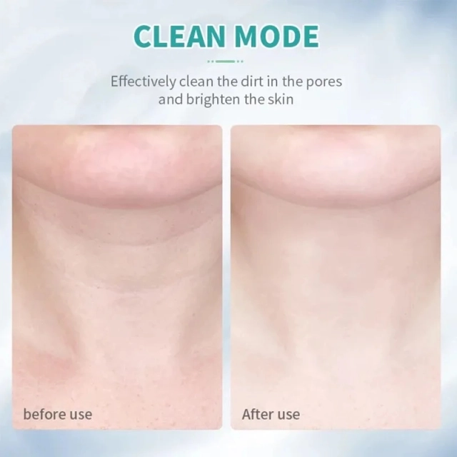 Tightening Wrinkle Removal Anti-Aging Facial Lift Wrinkle Remover Neck Facial EMS LED Light Beauty Device