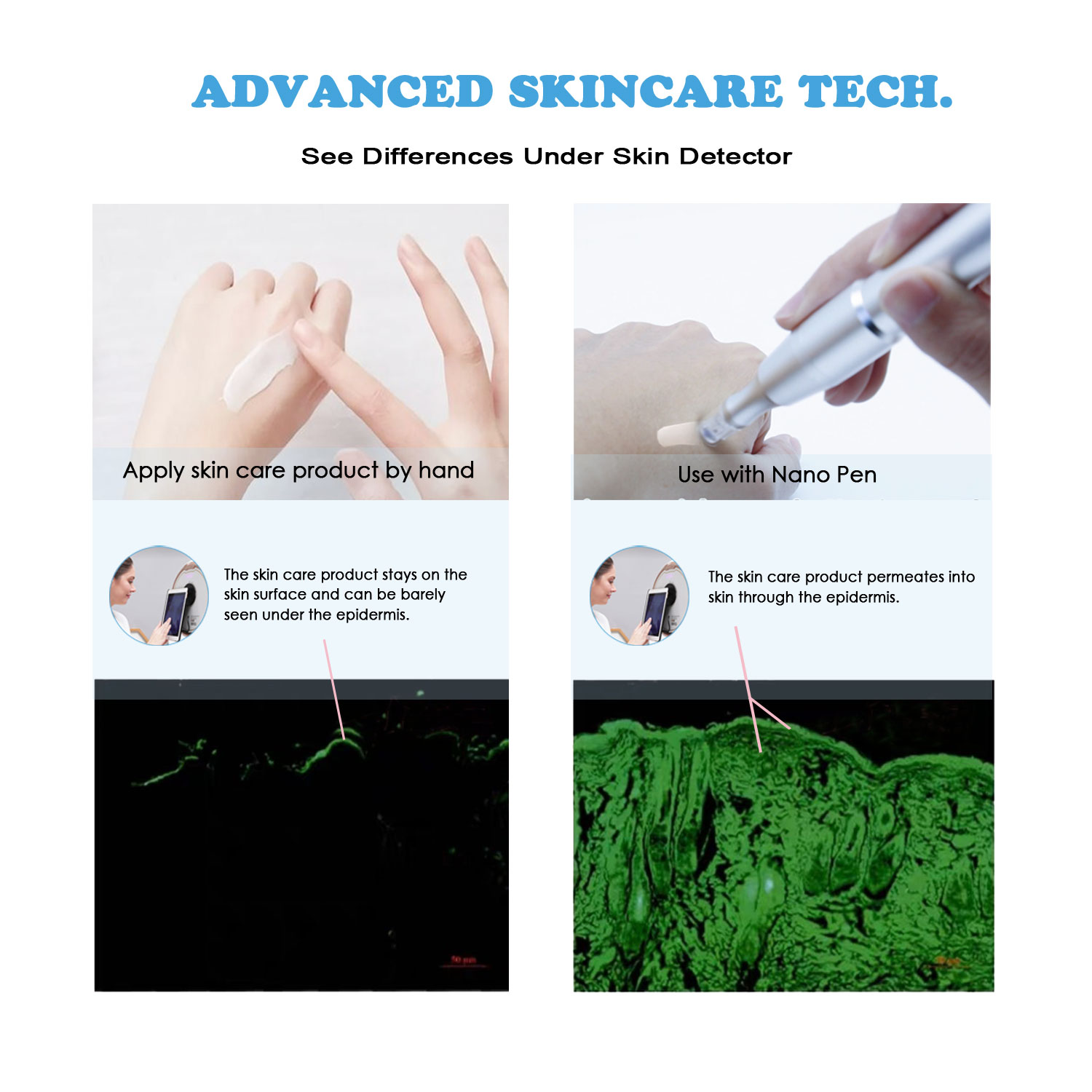 GloPen NP3 NanoNeedling AQUAPEN Skin Care Microneedling Derma Pen for Wrinkles Fines Sagging Skin Awarded NanoChip Technology Silicon Needle Cartridge