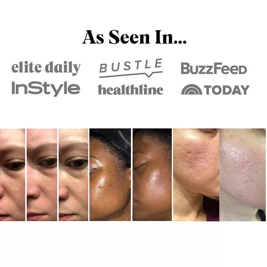 GloPen NP3 NanoNeedling AQUAPEN Skin Care Microneedling Derma Pen for Wrinkles Fines Sagging Skin Awarded NanoChip Technology Silicon Needle Cartridge