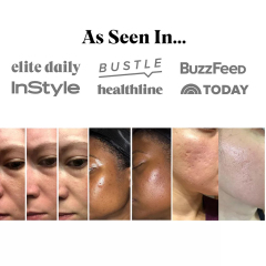 GloPen NP3 Nano Needling Pen Skin Care Microneedling Pen for Wrinkles Fines Sagging Skin Awarded NanoChip Technology CRYSTAL Silicon Nano Cartridge