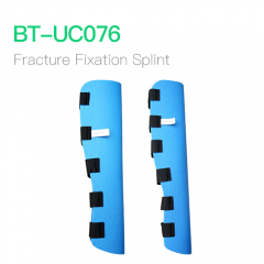 Fracture Fixation Splint