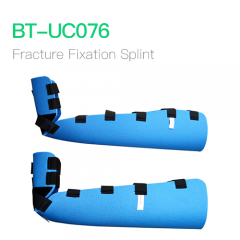 Fracture Fixation Splint