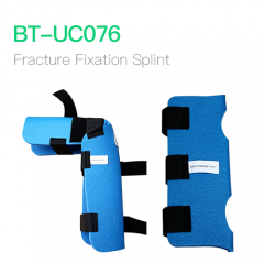 Fracture Fixation Splint