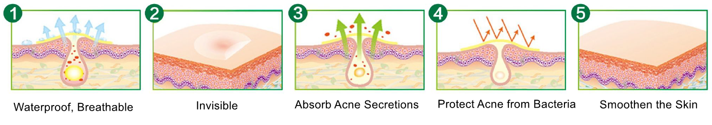 Heart Shaped Acne Pimple Spot Patches / Trummed Medical