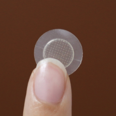 Dissolving Microneedle Acne Patch for Acne Treatment