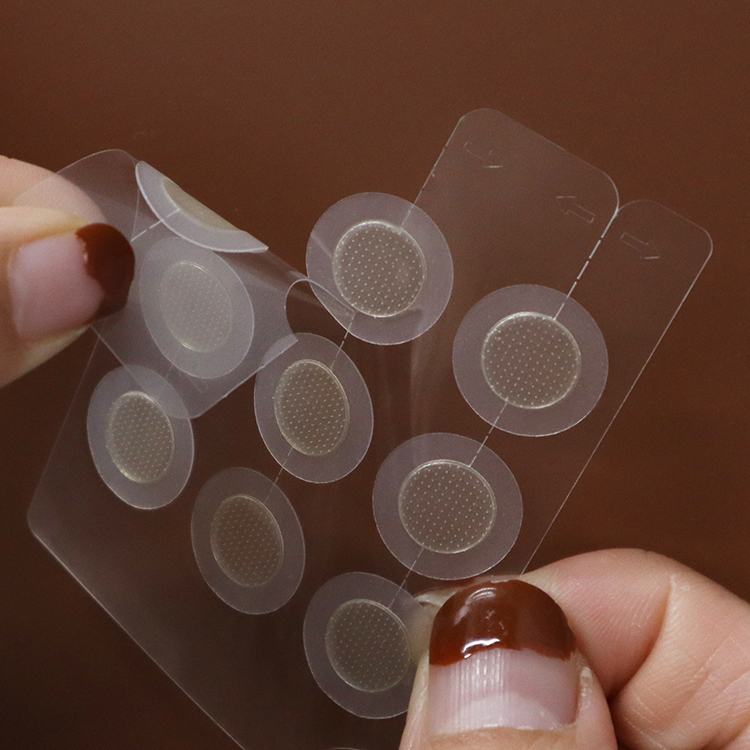 Dissolving Microneedle Acne Patch for Acne Treatment