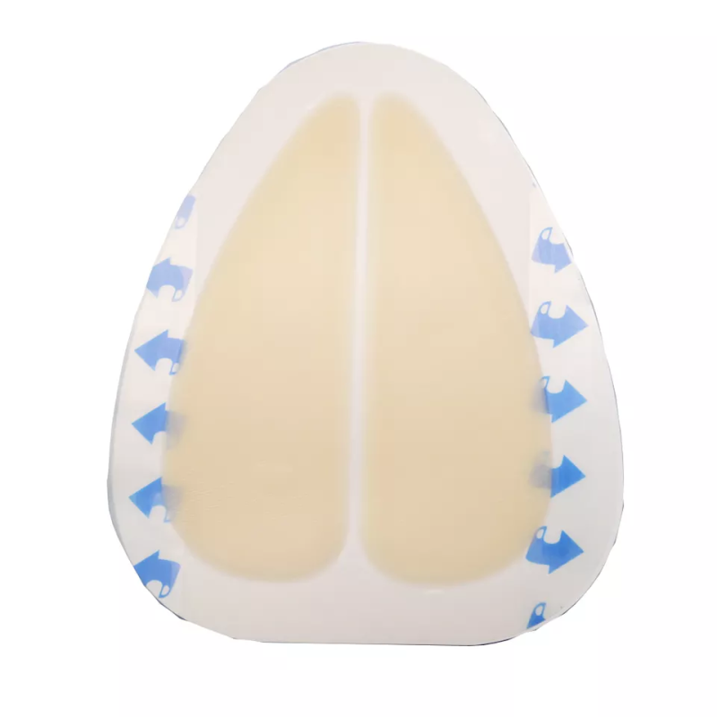 Bordered Hydrocolloid Wound Dressing for Sacral