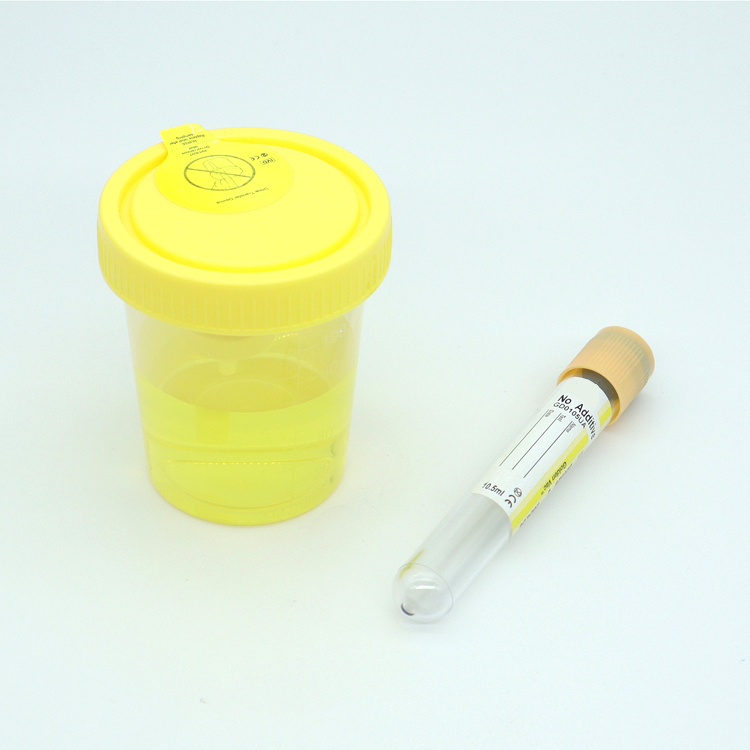 Vacuum Urine Collector