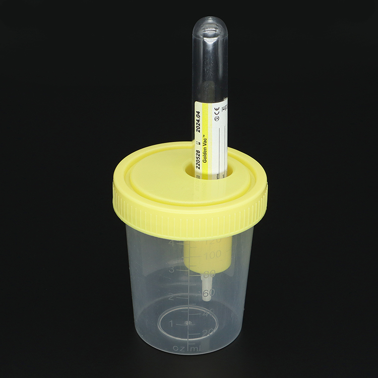 Vacuum Urine Collector