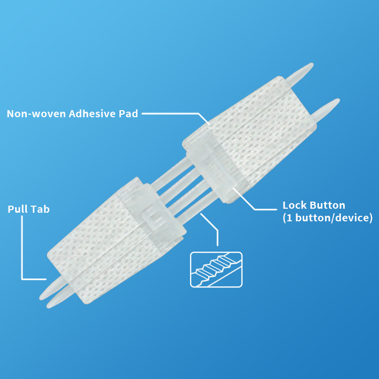 Non-Woven Wound Closure Device Single Type (White Color)