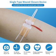 Non-Woven Wound Closure Device Single Type (Skin Color)