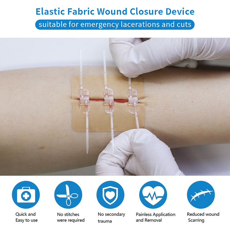 Elastic Fabric Emergency Wound Closure Device Wound Closure Device