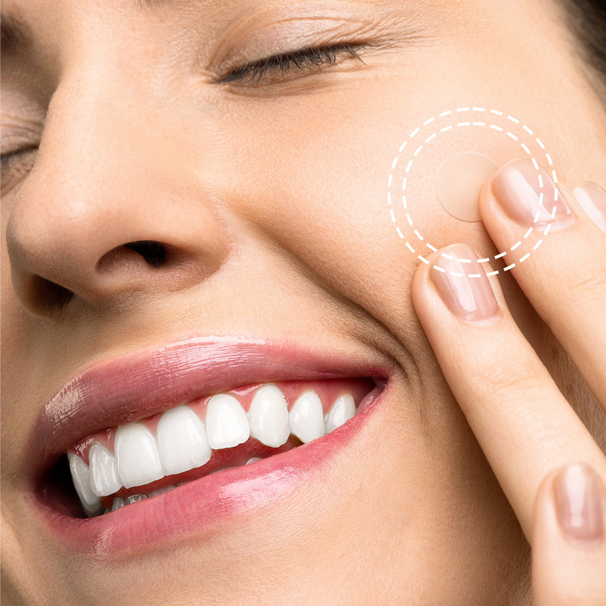 Can Pimple Patches Be Used Daily?