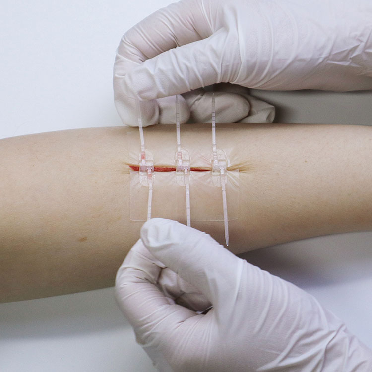 What is wound closure zipper? A MUST-HAVE first aid kit for closing wounds quickly wherever you are