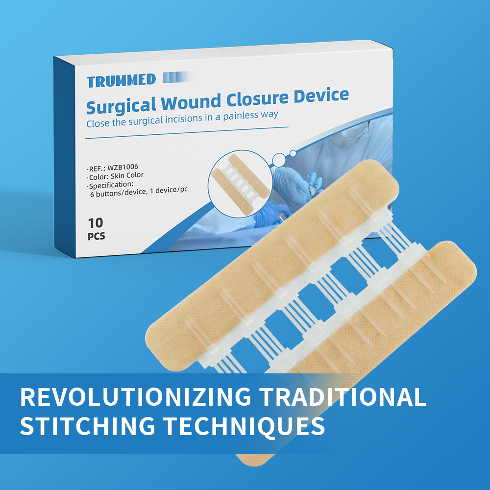 Choosing Wound Closure: Revolutionizing Traditional Stitching Techniques