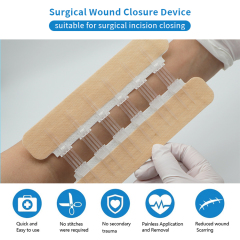 Non-Woven Surgical Wound Closure Device (Skin Color)