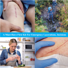 Elastic PU Film Zip Tie Wound Closure Device for Emergency Wound Closure