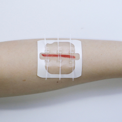 Elastic PU Film Zip Tie Wound Closure Device for Emergency Wound Closure