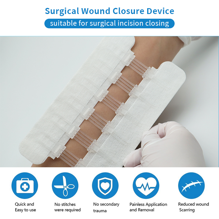 Non-Woven Surgical Wound Closure Device (White Color),Wound Closure Device