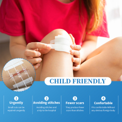 Elastic Hydrocolloid Wound Closure Device