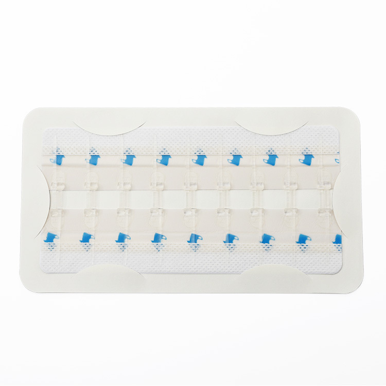 Elastic Hydrocolloid Wound Closure Device