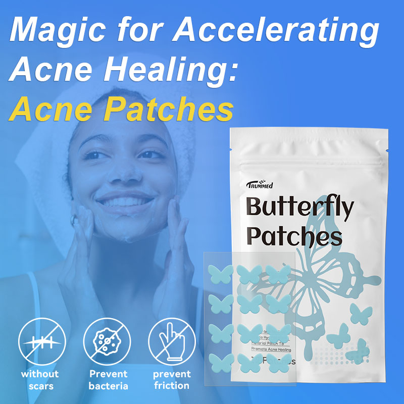 Magic for Accelerating Acne Healing：Acne Patches