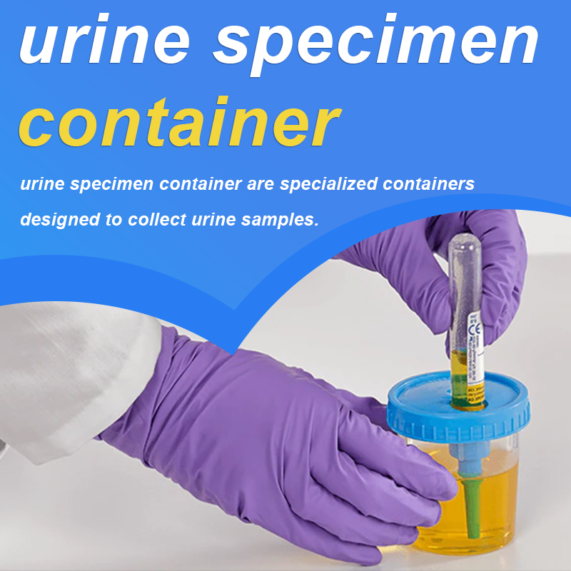 Trummed urine specimen container