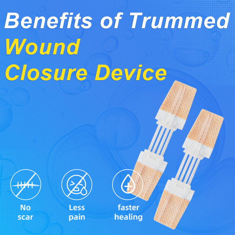 Benefits of Trummed Wound Closure Device