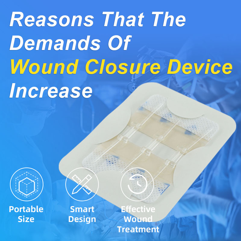 Reasons That The Demands Of Wound Closure Device Increase