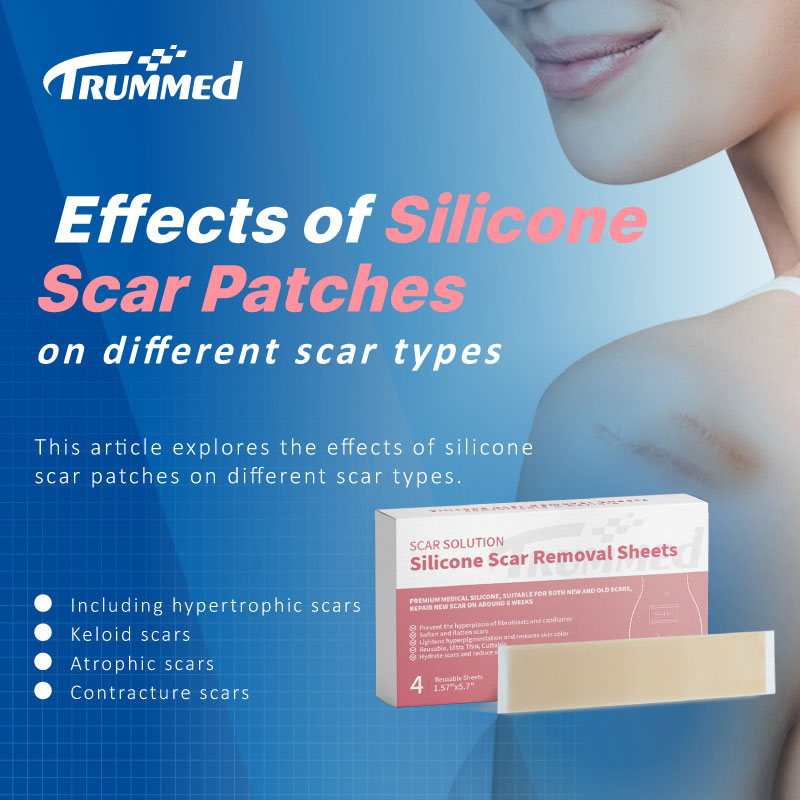 Effects of Silicone Scar Patches on Different Scar Types