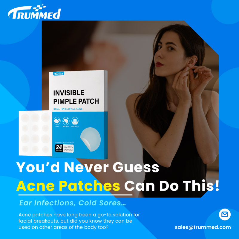 You’d Never Guess Acne Patches Can Do This!