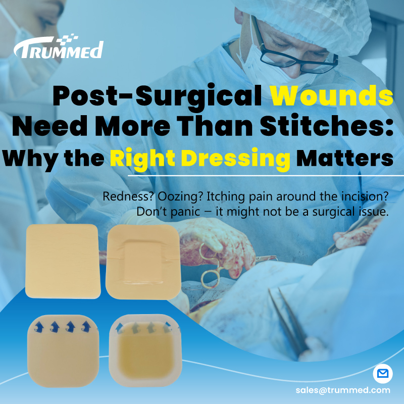 Post-Surgical Wounds Need More Than Stitches: Why the Right Dressing Matters