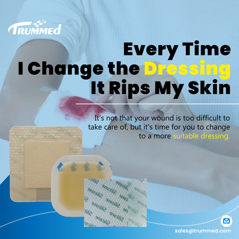Every Time I Change the Dressing, It Rips My Skin