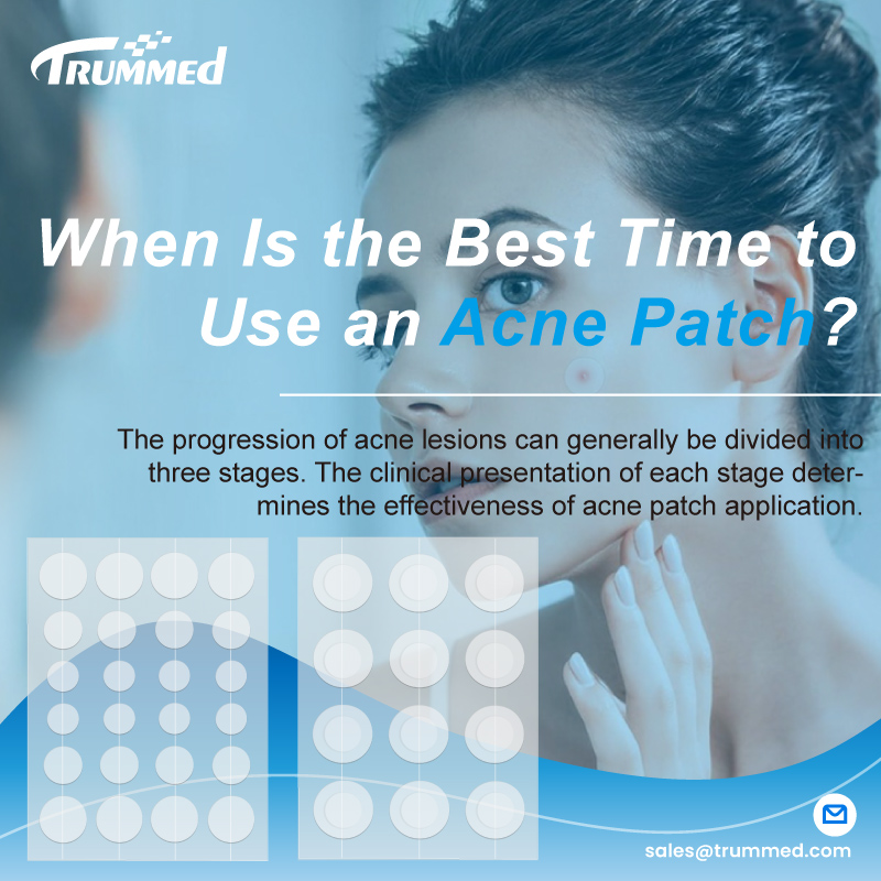 When Is the Best Time to Use an Acne Patch?