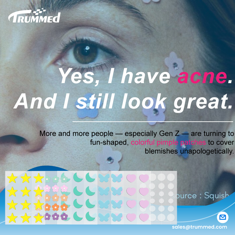 Yes, I have acne.And I still look great.