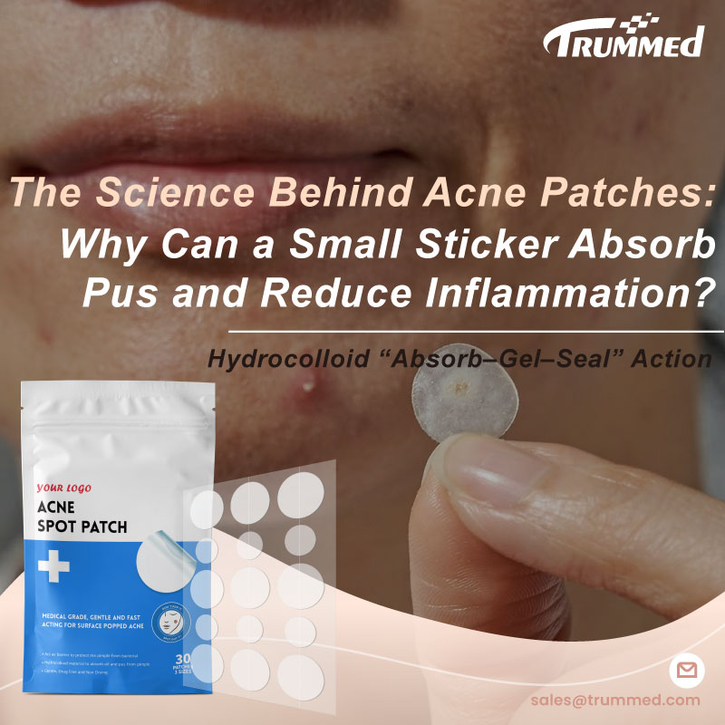 The Science Behind Acne Patches: Why Can a Small Sticker Absorb Pus and Reduce Inflammation?