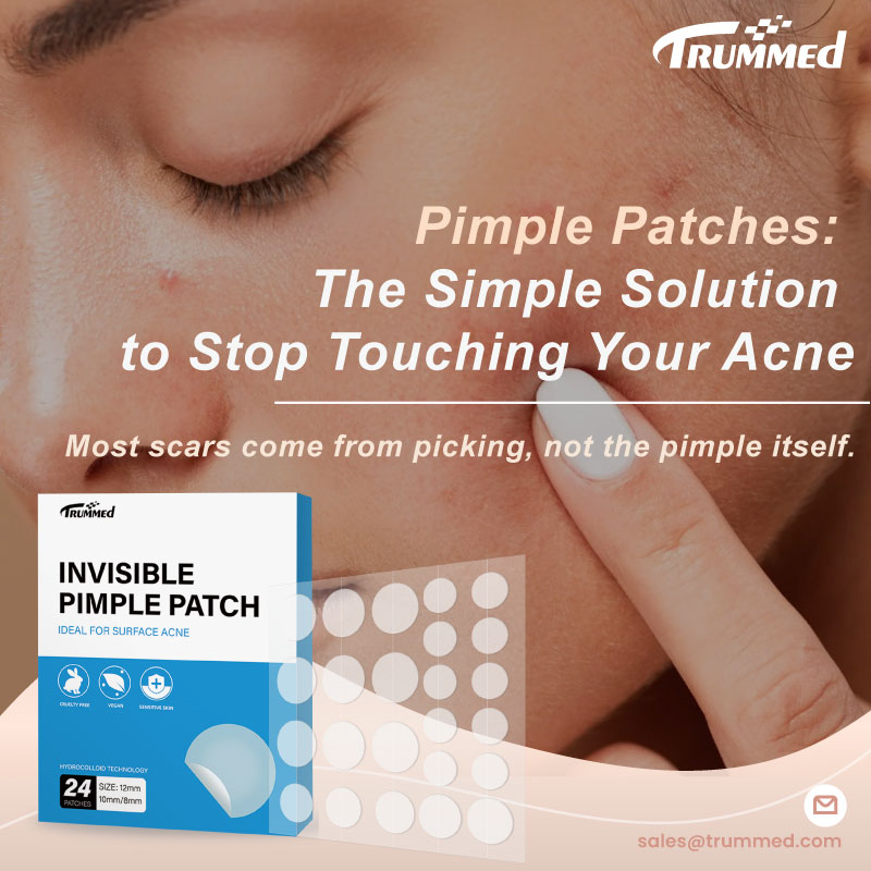 Pimple Patches: The Simple Solution to Stop Touching Your Acne