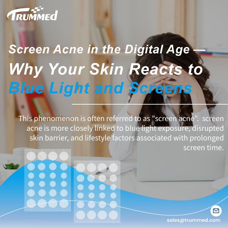 Screen Acne in the Digital Age — Why Your Skin Reacts to Blue Light and Screens