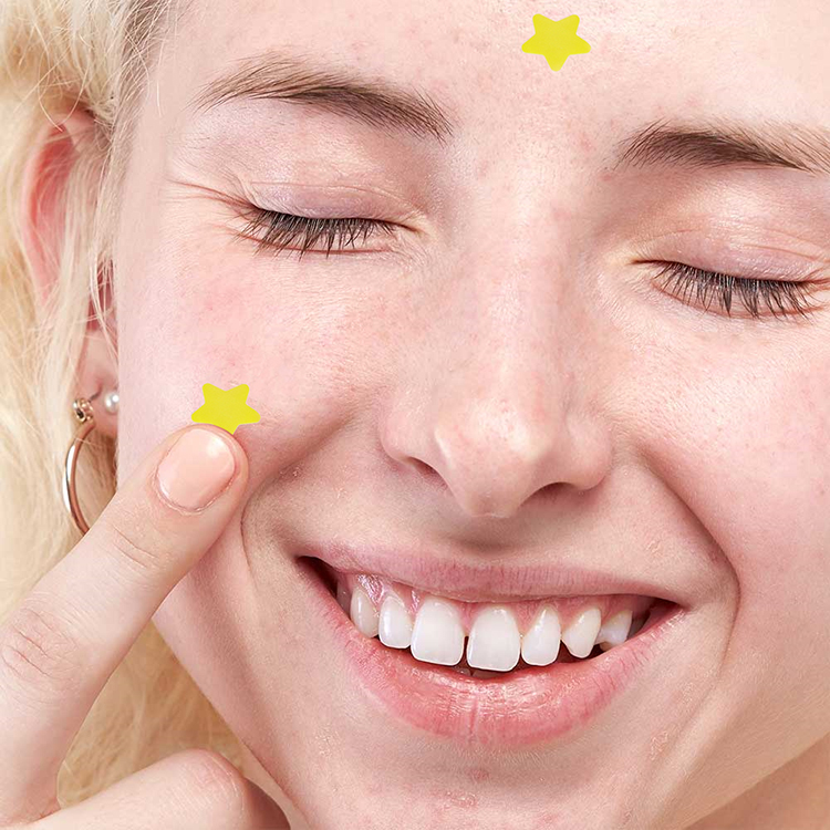 Star Shaped Pimple Patches